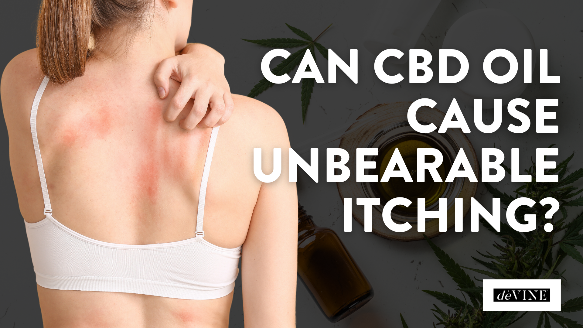 Can CBD Oil Cause Unbearable Itching?